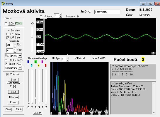 eeg-0-2.jpg