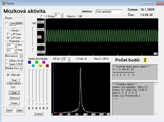 eeg-0-3.jpg